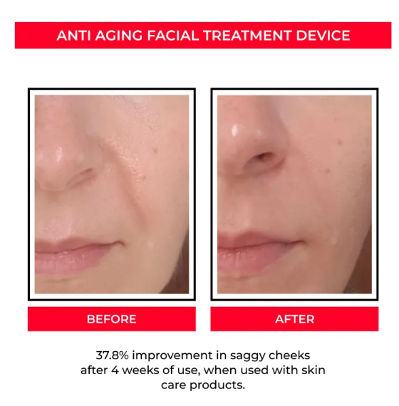 Skin Tool – Stylo Anti-Âge EMS & Microcourants